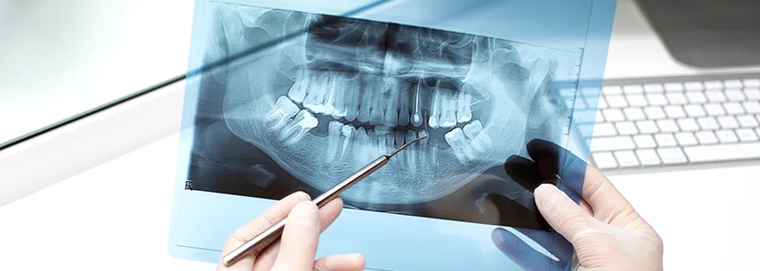 Rentgen zębów Tarnów