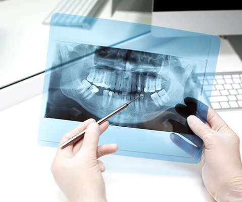 Badania radiologiczne RTG i CBCT EURODENT Tarnów