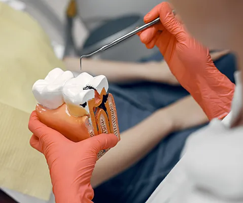 Endodoncja, leczenie kanałowe EURODENT Tarnów